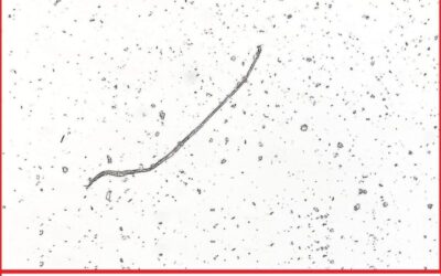 Uncovering the Truth: Investigating the Presence of Asbestos in Talc