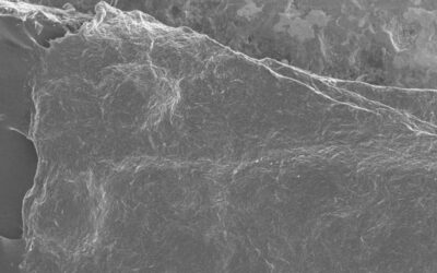Corneal Lenticule Analysis through the Lens: Integrating Scanning Electron Microscopy and Optical Microscopy Techniques